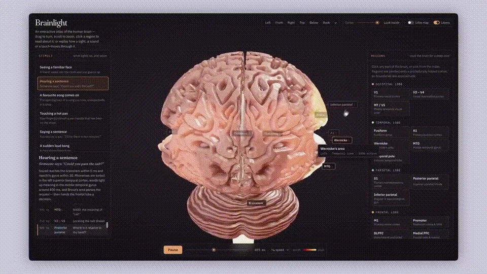 Interactive brain model